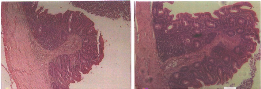 طول پرز روده در ناحیه ایلئوم روده جوجه های گوشتی بدون مصرف پروبیوتیک (چپ) و دریافت کننده پروبیوتیک های لاکتوباسیلوسی (راست) 